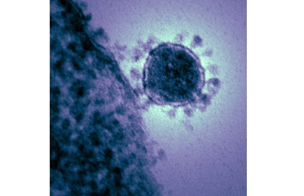 MERS Coronavirus