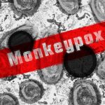 Monkeypox