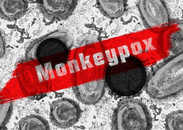 Monkeypox